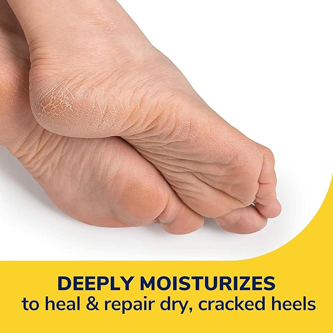 Dr. Scholl's Severe Cracked Heel Repair Restoring Balm 2.5oz, with 25% Urea for Dry, Cracked Feet, Heals and Moisturizes for Healthy Feet