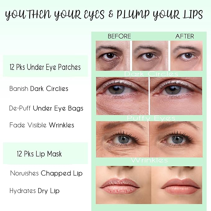 CCbeauty 24 Packs Lip Masks & Eye Mask Bulk,24K Gold Under Eye Patches for Puffy Eyes,Dark Circles,Collagen Eye gel Pads for Eye Bags,Wrinkles | Nourish & Hydrate Dry Chapped Lips Skincare, Pink