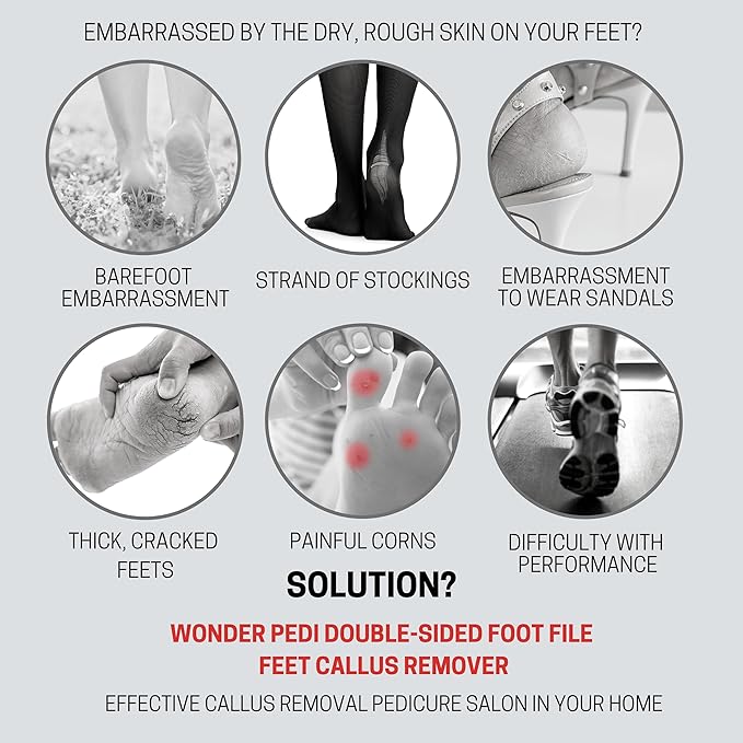 Made in Germany Double Sided Foot File Callus Remover, Stainless Steel and Emery Sides Feet Scrubber, Professional Pedicure Foot Care Tool Rasp, Long Lasting Foot Buffer, Heel Scraper, Wonder Pedi