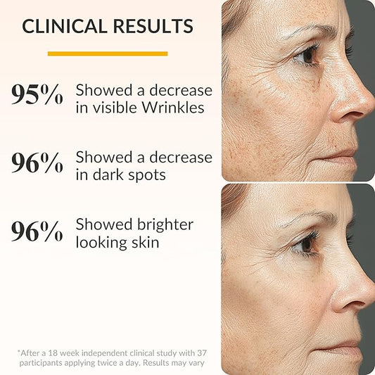 Levaye Vitamin C Serum – Anti Aging Facial Serum with Vitamin C, ferulic acid, Hyaluronic Acid, Vitamin E – Brightening Serum. Targets Dark Spots, Fine Lines, Wrinkles, Dry Skin, Firmness, 1.7 Fl Oz