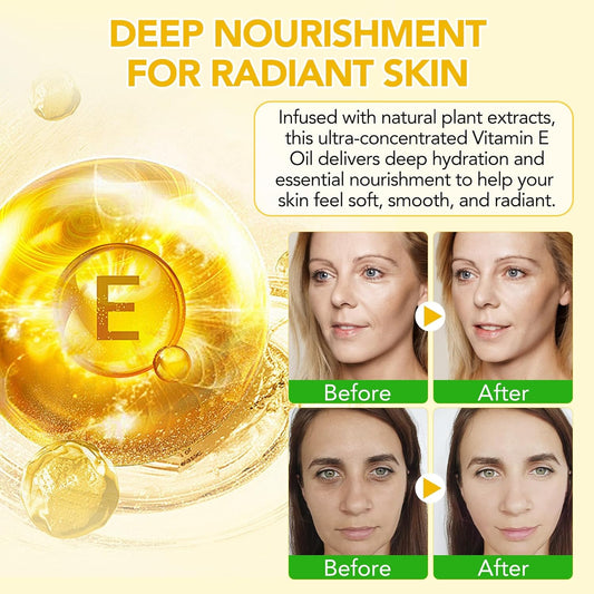 Vitamin E Oil for Skin 75,000 IU, 2Fl Oz Pure Vitamin e Oil for Scars, Hair, Face and Scalp, Moisturizing Dry Skin, Reduces Winkles and Fine Lines, Perfect Bath and Body Oils