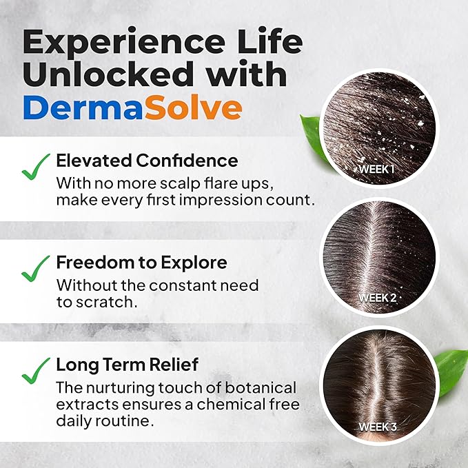 Dermasolve Psoriasis & Dandruff Oil, Dermatologist Approved for Flaky Scalp Relief