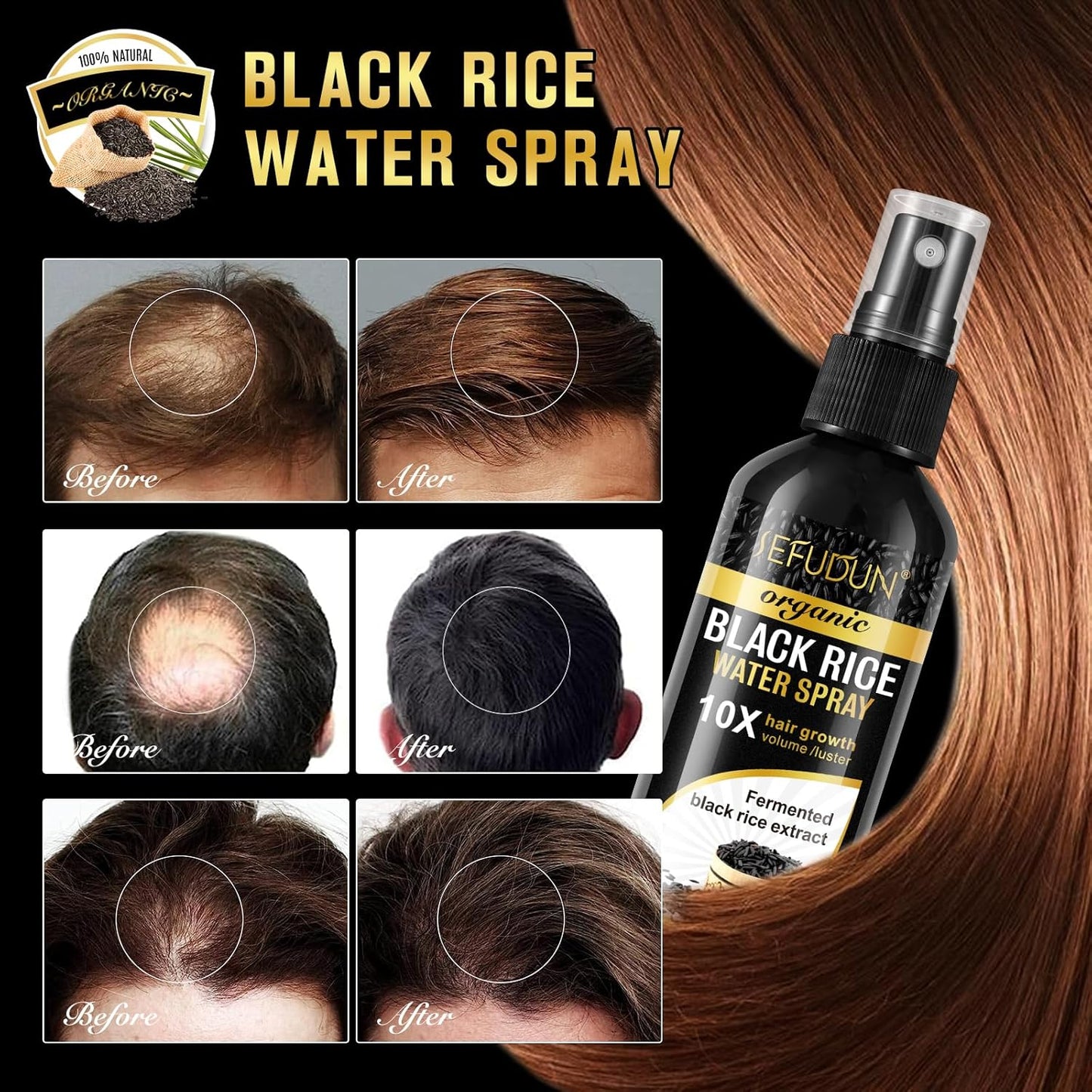 Organic Black Rice Water Spray for Hair Growth, A Solution with Castor Oil & Ginger Root Extract for Thicker, Fuller Hair, Targets Hair Loss and Repairs Damage 200ml/6.4 fl.oz (2 PC)