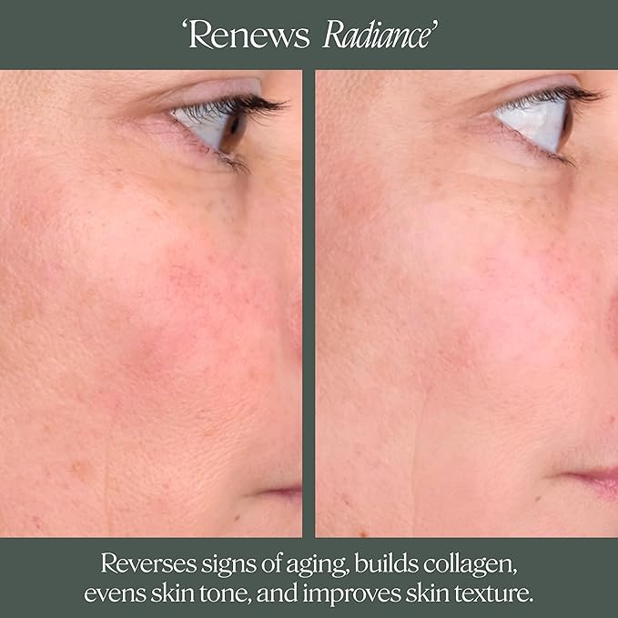 Doctor Rogers Night Repair Treatment. Restoring & Hydrating Anti-Aging Face Serum with Glycolic Acid, 1 Ounce (30 ml)