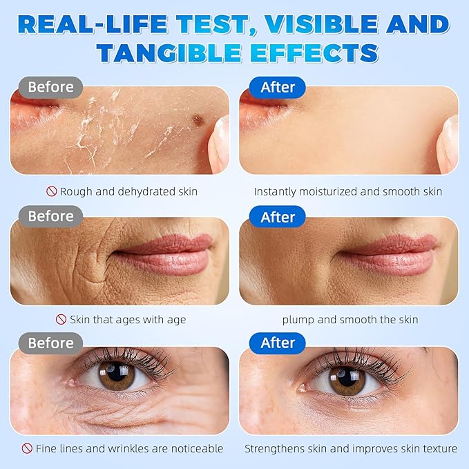 3% Hyaluronic Acid Serum Ultra-Hydrating Vials (1 Box of 30), 3% Hyaluronic Acid Serum for Face, Single-Use 3% hyaluronic acid tubes, Intensive Hydration, Skin Tightening & Smoother, Anti-Aging