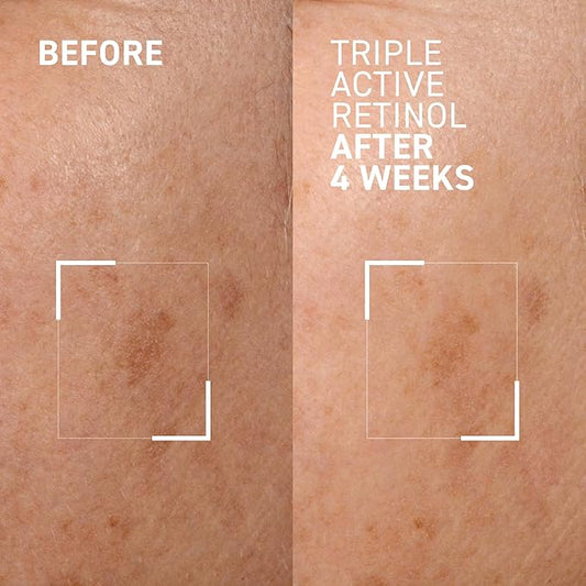 Dr. Brandt Bright This Way Triple Active Retinol - Gentle Overnight Renewal Cream - Reduces Wrinkles & Discoloration, Illuminates & Hydrates - 1 oz