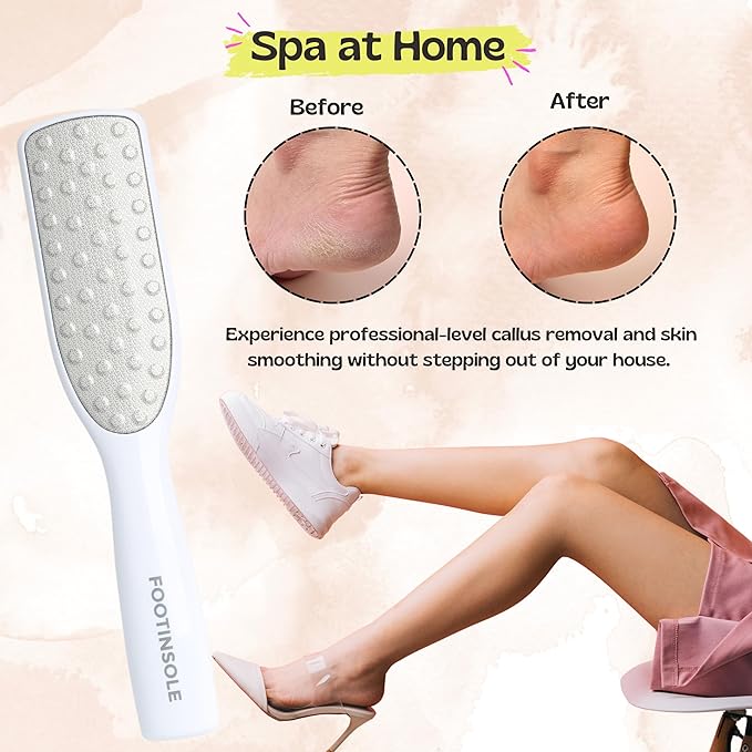 Professional Dual-Sided Foot File : The Essential Callus Remover for Effortlessly Smooth and Soft Feet (Gold)