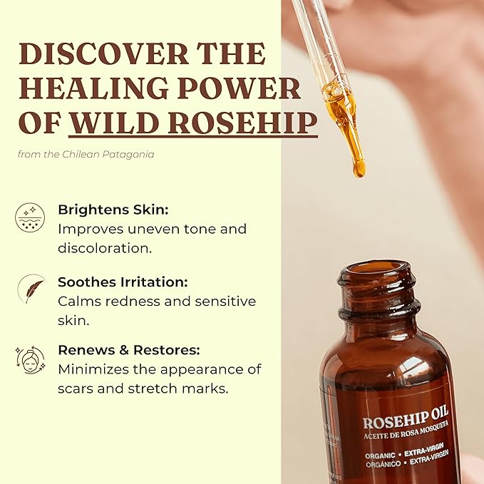 Organic Rosa de Mosqueta Oil- USDA Certified Rosehip Seed Oil Pure Cold Pressed, Repairs & Brightens Skin - Gua Sha Massage, Face, for All Skin Types - Aceite Facial 1OZ