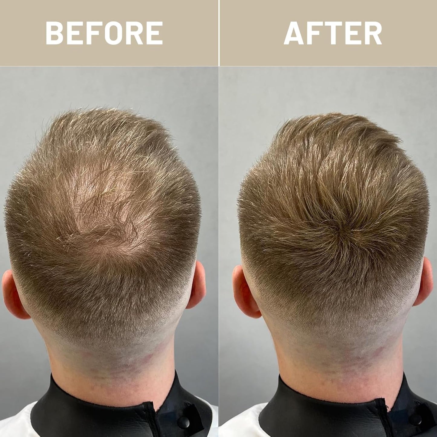 VOLLUCK Hair Fibers for Thinning Hair, Instant Coverage Hair Building Fibers for Women and men, Natural Hair Powder for Conceal Hair Loss 28 g (Medium Brown)