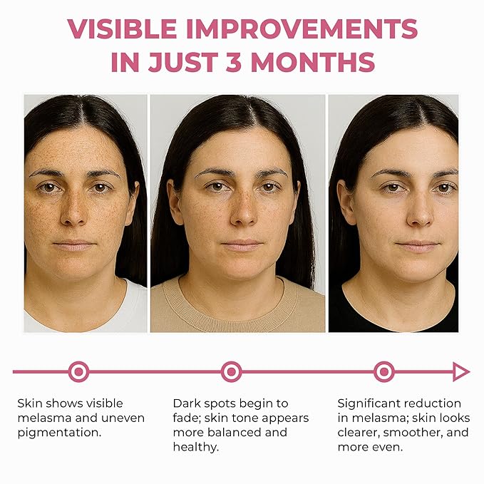 Abera Skin Renewing Serum, Melasma Treatment For Face, High-Performance Anti-Aging, High Potency Saffron Extract, Hydrating Serum,1.01 Fl Oz