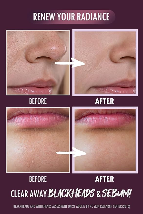 NEOGEN PORE TIGHT PEELING MOUSSE 2.7 oz / 80ml