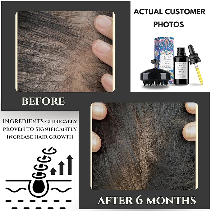 USDA Organic Hair Oil Treatment for Intense Nourishment, Dry Scalp Relief, and Hair Growth Promotion - Silicone Head Massager for Relaxation and Exfoliation