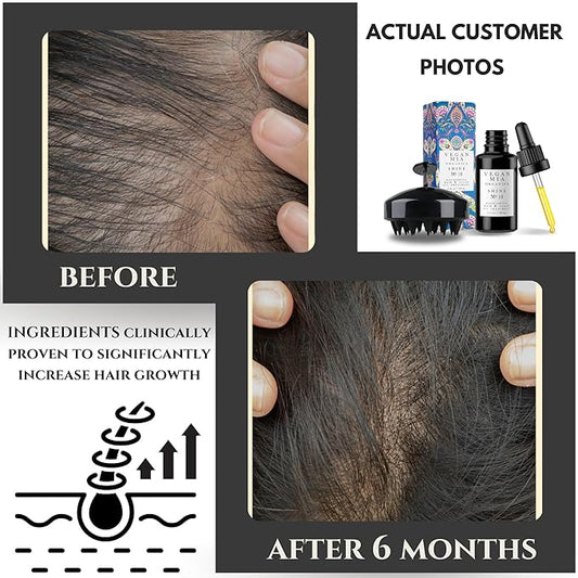 USDA Organic Hair Oil Treatment for Intense Nourishment, Dry Scalp Relief, and Hair Growth Promotion - Silicone Head Massager for Relaxation and Exfoliation