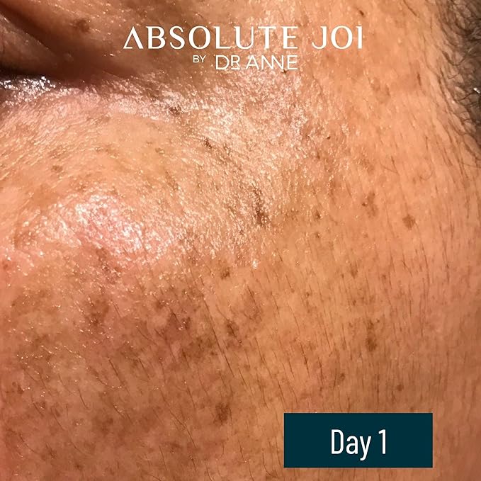 Retinol Oil Serum with Vitamin C, Skin Refining Night Oil for Fine Lines and Hyperpigmentation with Sensitive Skin Friendly Granactive Retinoid - Unscented - 1 Fl Oz Full Size