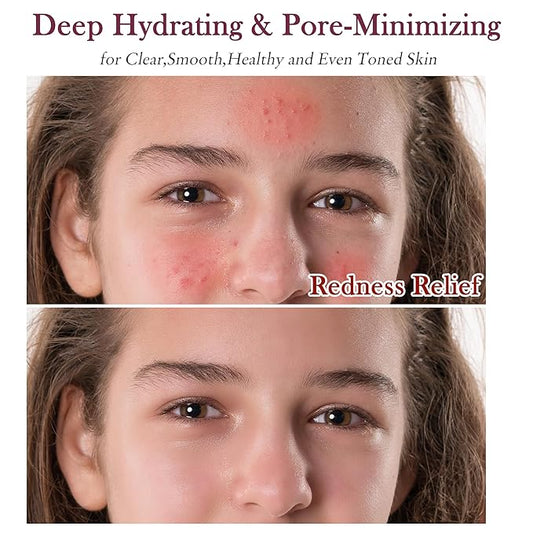 Skin Care Set Kit,Professional Pore Minimizer Soothe, Hydrate, Oil Control, Deep Cleanse Women Teen Girls Skincare Facial Skin Care Products,Travel Facial Skin Care Routine Kit Women Beauty Gift Set