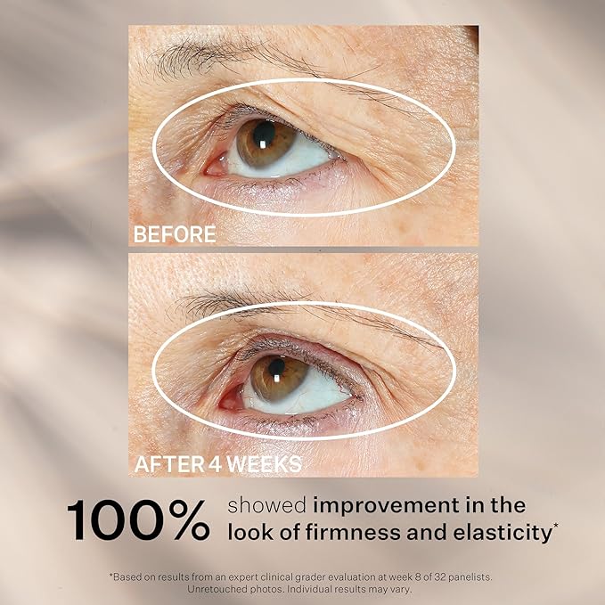 StriVectin Tighten and Lift Peptight 360 Degree Eye Serum with Tightening and Brightening Peptides for Wrinkles, Under Eye Bags and Puffiness, 1 fl. Oz