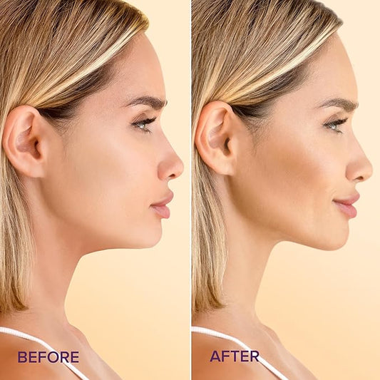 MAREE V Line Lifting Mask with 24K Gold - Deep Collagen Jawline Shaper Mask with Retinol for Face Lift - Facial Skincare Chin Strap - Hyaluronic Acid, Vitamin E - 5 Count