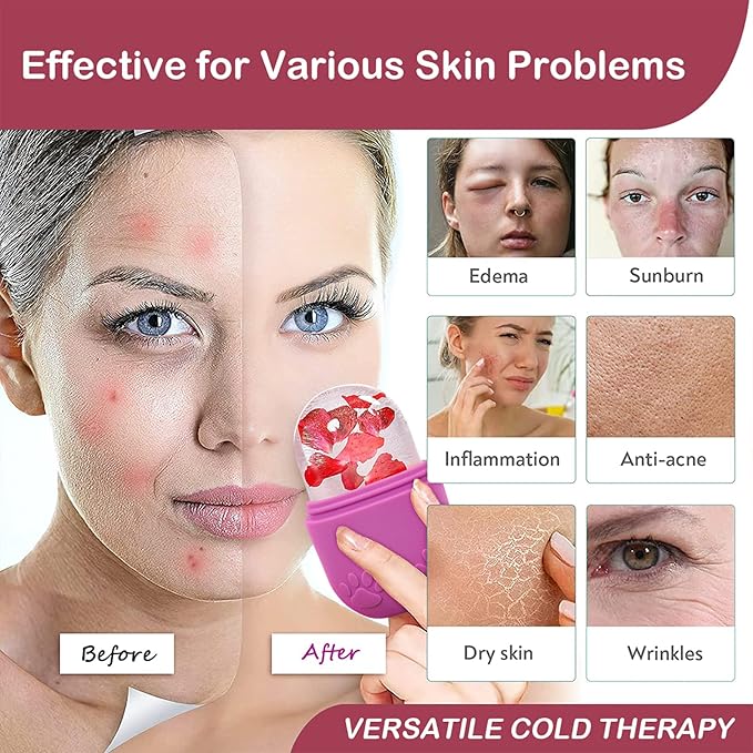 Ice Roller for Face & Eye, Facial Cold Massage Freezer Rollers, Multi-Functional Silicone Ice Face Mold Skin Care Tools for Puffiness Relief, Shrink Pores & Remove Fine Lines (Rose Red)