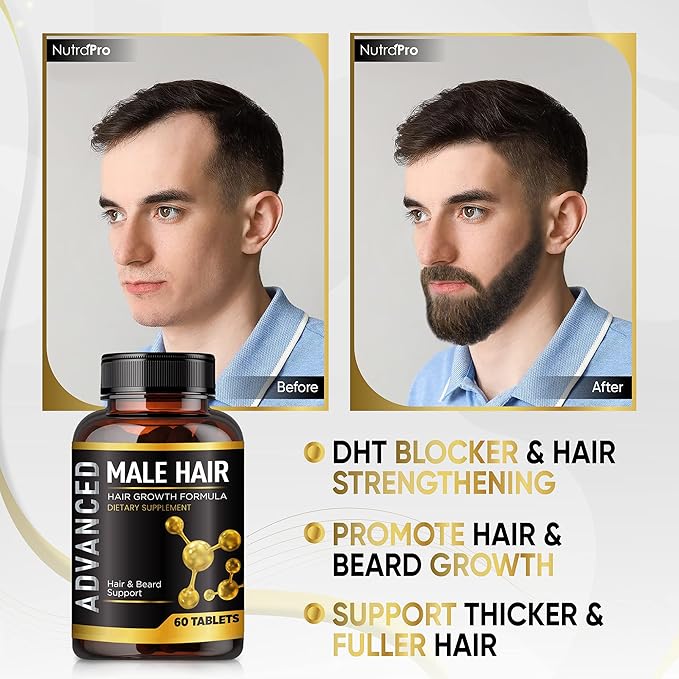 Hair Growth Vitamins For Men-Anti Hair Loss Support Vitamins Pills & Dht Blocker For Men.Regrow Hair & Beard Growth Supplement For Thicker Fuller & Stronger Hair. Support Thinning Hair With Biotin.