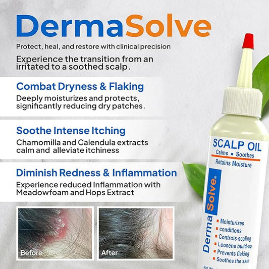 Dermasolve 4 oz Psoriasis, Seborrheic Dermatitis, & Dandruff Scalp Oil - Dermatologist Approved - Flaky Scalp Relief, Clinically Tested, Long-Lasting Itch-Free, High-Performance Formula