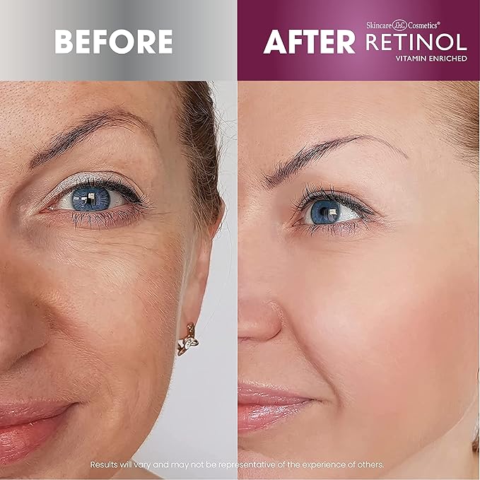 Retinol Anti-Aging Eye Stick – Hydrates, Firms, Brightens, and Smooths Fine Lines 6X Super Serum – Unique, Intensive Formula Accelerates Skin Renewal While You Sleep.