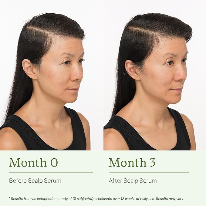 Divi Scalp Serum, Clinically Tested Hair Growth Formula, for Fuller and Thicker Hair - 30ml - 2 Pack