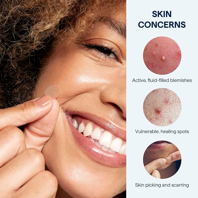 Remedy for Pimples - 36 Near-Invisible Medical-grade Hydrocolloid Pimple Patches for Blemishes, Zits, Spot Concealing - By Dermatologist Dr. Shah