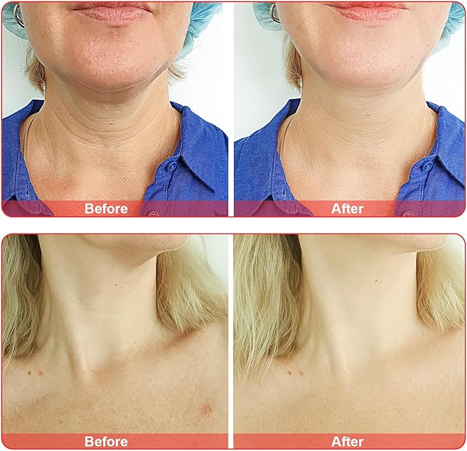 Electrode Wand Glass Tube Handheld Spare Parts for Hi Frequency Instrument Elitzia ETHB01 (Purple Y Shape)