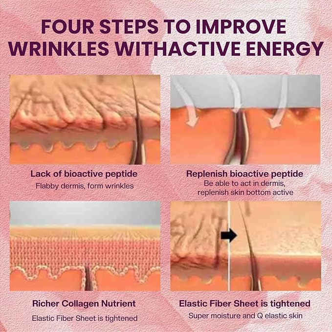 Facial & Forehead Wrinkle Patches: Anti Wrinkle Patches To Smooth Eye, Smile Line And Forehead Wrinkles - Wrinkle Patches For Face Overnight 192pcs