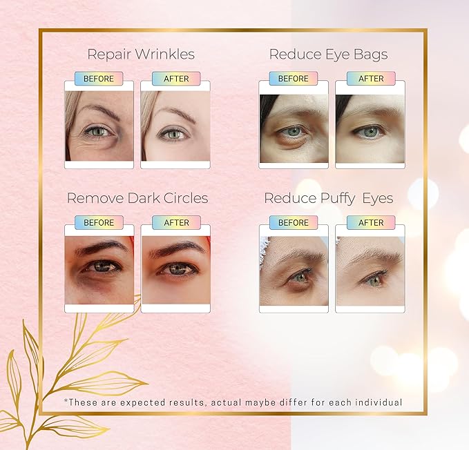 Get Amazing Results 24K Gold Under Eye Hydrogel Patches[60Pcs] With Licorice Extract, Hyaluronic Acid, Collagen & Glycerin Specialized for Puffy Eyes, Dark Circles and Wrinkles