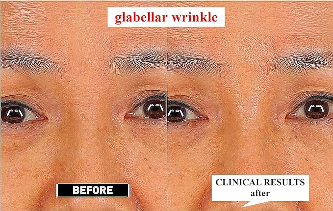 [K-Beauty Retinaldehyde 1000ppm & Liposome Anti-Wrinkle Night Repair Cream (1oz /30ml)