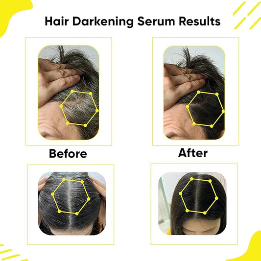 Masofta Hair Darkening Serum with Arcolys, Melano Gray, Biotin & Bhringraj for Promoting Darker, Shinier Hair and Beard, Suitable for Both Men & Women, 1.01 fl.oz./30 ml