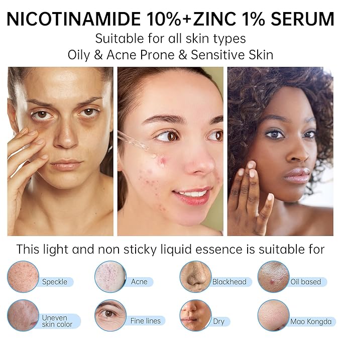 Niacinamide 10%+ Zinc 1% Serum For Face, Niacinamide Serum For Face, Dermatologist, Redness Relieve-30ml 1floz