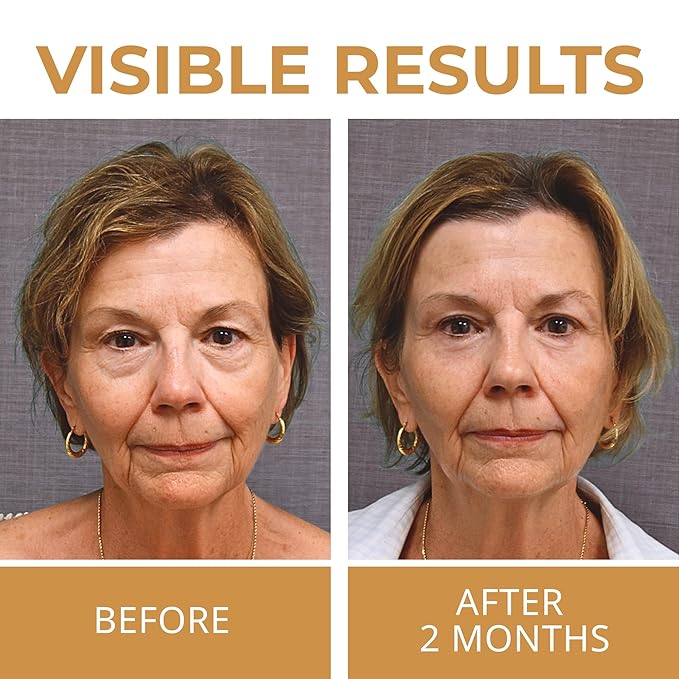 ABERA Natural Repair Eye Cream, Minimizes Under Eye Bags & Puffiness, Reduce Wrinkles, Fine Lines and Dark Circles, 0.5 fl oz