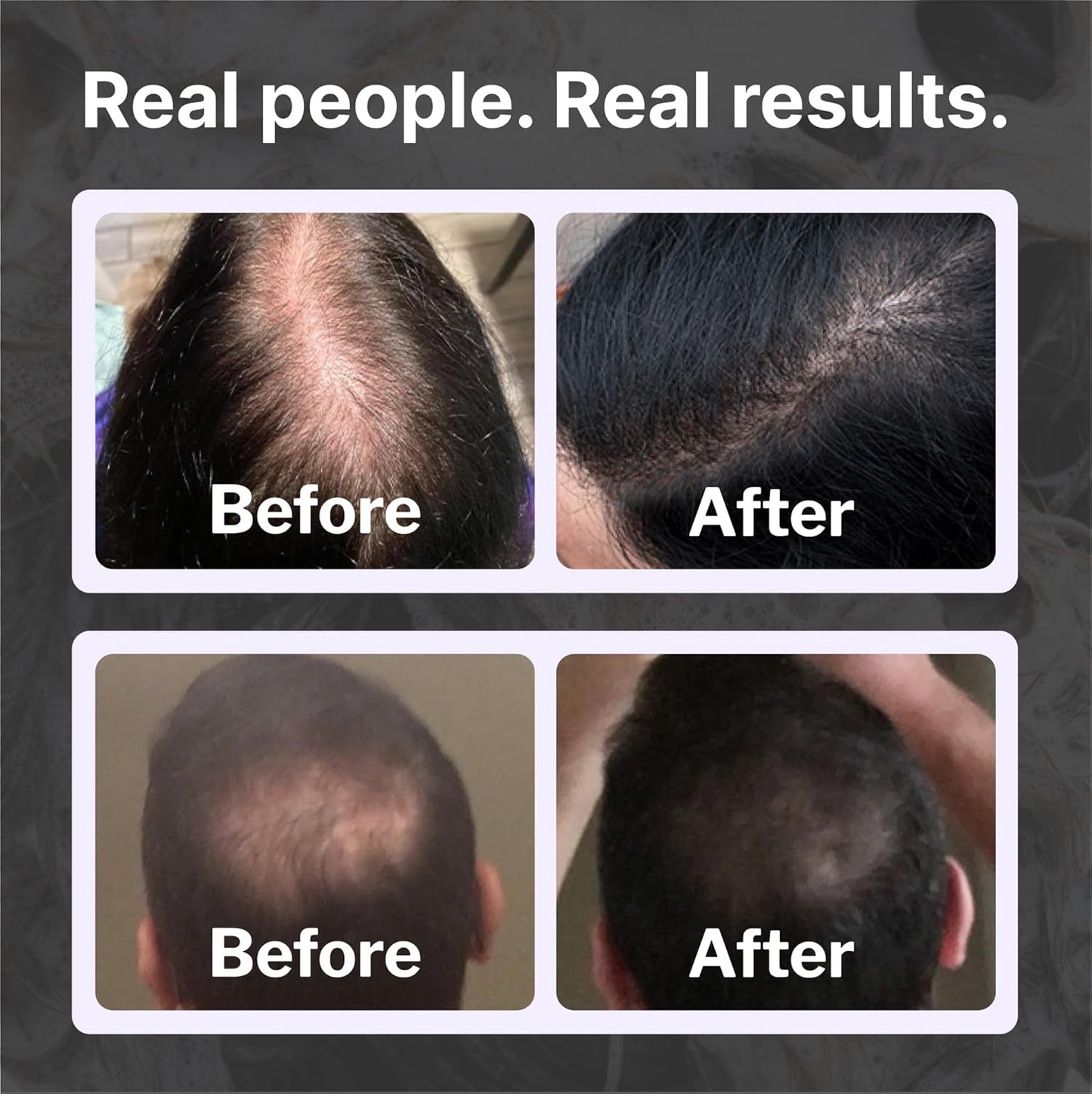 Shapiro MD Hair Growth Experts Hair Loss Shampoo | DHT Fighting Vegan Formula for Thinning Hair Developed by Dermatologists | Experience Healthier, Fuller and Thicker Looking Hair | 1 Month Supply