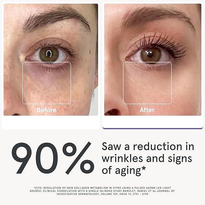 iRestore Red Light Therapy for Eyes – 180 LEDs Eye Mask with Infrared Light for Under-Eye Wrinkles, Forehead Lines, 11's, Crow’s Feet, Dark Circles – Enhances Results of Eye Cream, Lash & Brow Serums