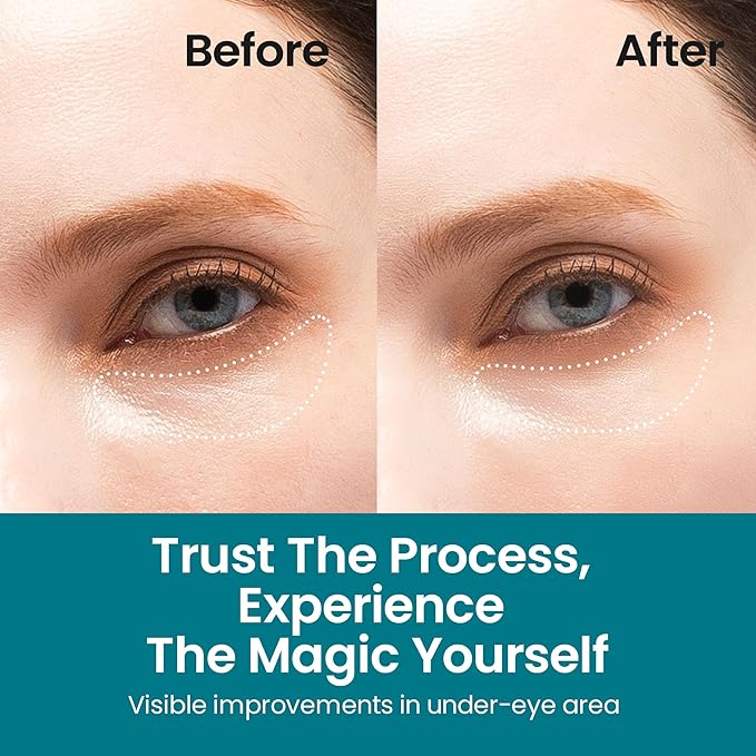 NURIVE's Youthful Skin & Bright Eyes Pack | Depuffs and Brightens Your Under Eye Bags | Helps Minimize Fine Lines and Wrinkles for Sensitive Skin