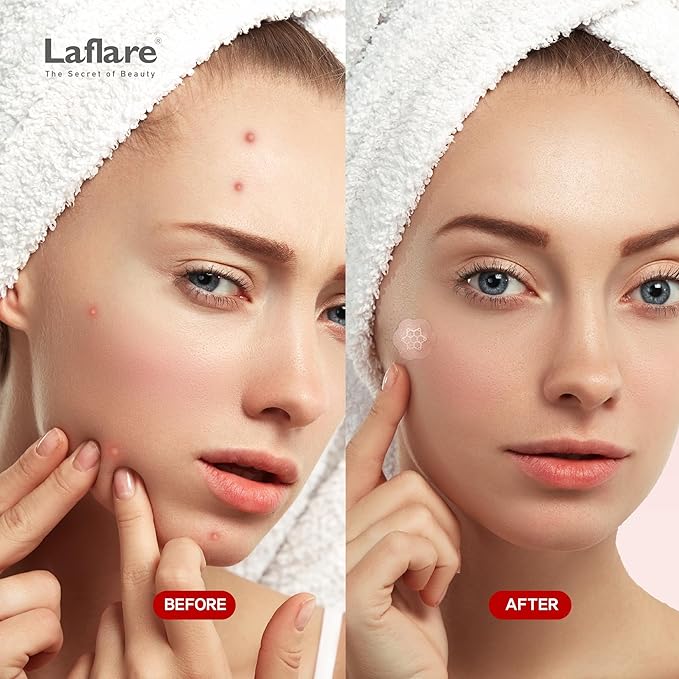 FreeGo Magnesium Acne Patches for Face. Blemish.Zit & Dark Spots from Post-Blemish, Acne .Zit. Self Dissolving,Hydrocolloid, Tee Tree oil & more (S 15pc)