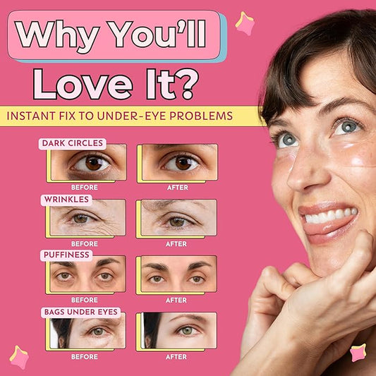 RevitalEyez Brightening Hydrogel Under Eye Patch with Niacinamide, Collagen & Rose Petals for Puffy Eyes, Wrinkles, Dark Circles (10 pairs)