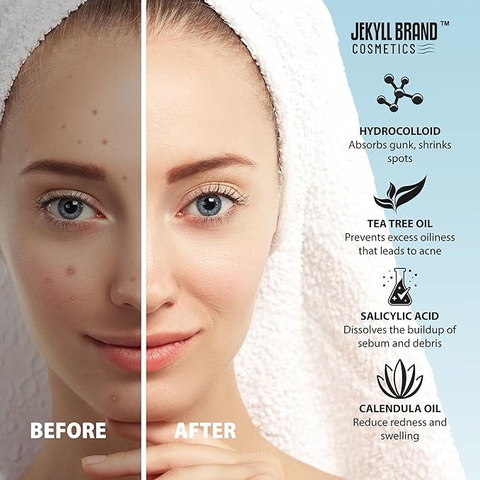 Acne Face Patches-XL (6 sets) COSMETICS™ | Medical Grade | Hydrocolloid Mask for Acne | 6 Sets of Large Patches for Breakouts on Nose, Chin, Cheeks & Forehead | Dermatologist Approve