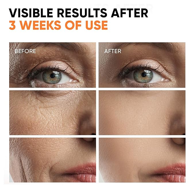 Vitamin C Serum 20%, Anti Aging Stem Cell Serum for Face with Hyaluronic Acid, Collagen Peptides, Vitamin E, Korean Skin Care Brightening Dark Spot Corrector for Wrinkles, Age Spots & Fine Lines, 1 oz