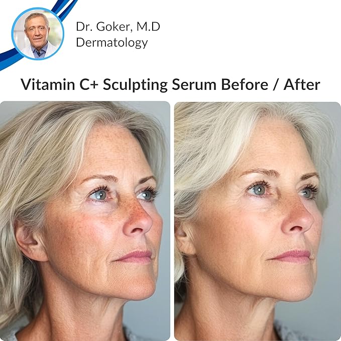 Levaye Vitamin C Serum – Anti Aging Facial Serum with Vitamin C, ferulic acid, Hyaluronic Acid, Vitamin E – Brightening Serum. Targets Dark Spots, Fine Lines, Wrinkles, Dry Skin, Firmness, 1.7 Fl Oz