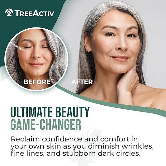 Hyaluronic Acid Wrinkle Serum, Vitamin C Serum for Face with Hyaluronic Acid, Retinol Serum for Face for Skin Elasticity, Fine Lines, and Dark Spots, Wrinkle Serum, 60-Day Supply TreeActiv