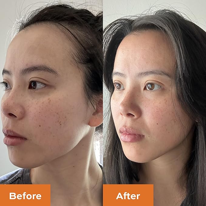 KNOW Beauty Arctic Gold Vitamin C Mask - Brighten Dull Skin, Remove Dark Spots and Pigmentation, Reverse Sun Damage, Boost Collagen, For All Skin Types - With Cloudberry and Tetrahexyldecyl Ascorbate