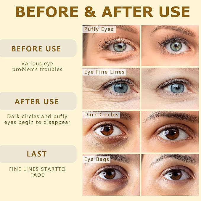 24k Gold Vitality-Fill Eye Patches (30 Pairs)|Anti-Aging Hydra-Gel Under Eye Patches, Boost Lift & Firm the Look of the Eye Area|Eye Patches for Puffiness,Bags,Dark Circles Under Eyes|Gold Pure Luxury