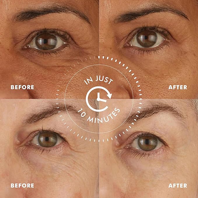 skyn ICELAND Hydro Cool Firming Under Eye Patches with Peptides and Coenzyme Q10 Instant Cooling Relief for Tired Puffy Eyes, 8 Pairs