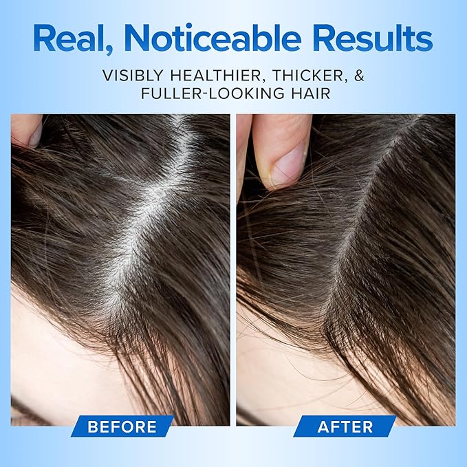 Hair Growth Shampoo and Conditioner for Men and Women - Dry Scalp Treatment, Moisturizing Shampoo and Conditioner - Sulfate Free and Fragrance-Free - Volumizing Hair (4oz)