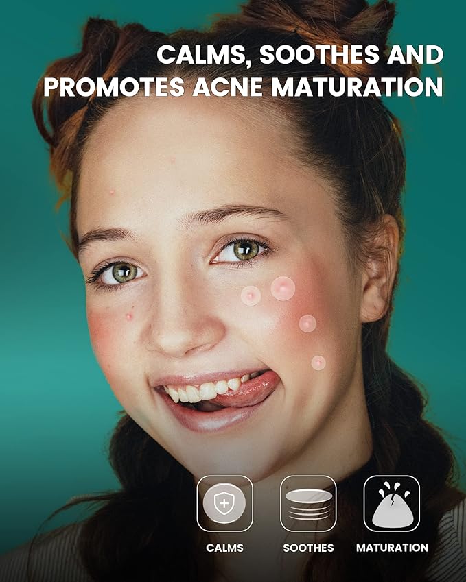 Pimple Patch 210 Counts 4 Sizes, Hydrocolliod Acne Patch for Face, Invisible Zit Patch with Tea Tree Oil & Calendula Oil, Blemish Patch, Vegan and Cruelty Free