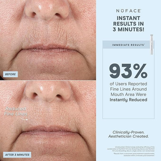 NuFACE FIX Line Smoothing Starter Kit - FDA Cleared Microcurrent Device + Serum Activator for On-The-Go Treatment of Forehead Lines, Crow's Feet, Under Eyes, Smile & Fuller-Looking Lips