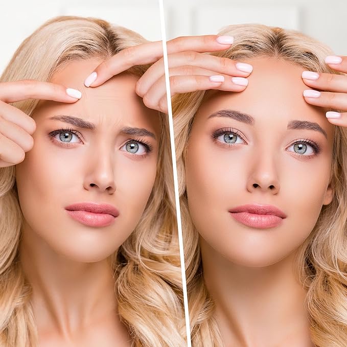 Forehead Wrinkle Patches For Anti-Wrinkle: Facial Wrinkle Patches for Forehead Fine Lines & Frown Lines - Overnight Mask with Peptide